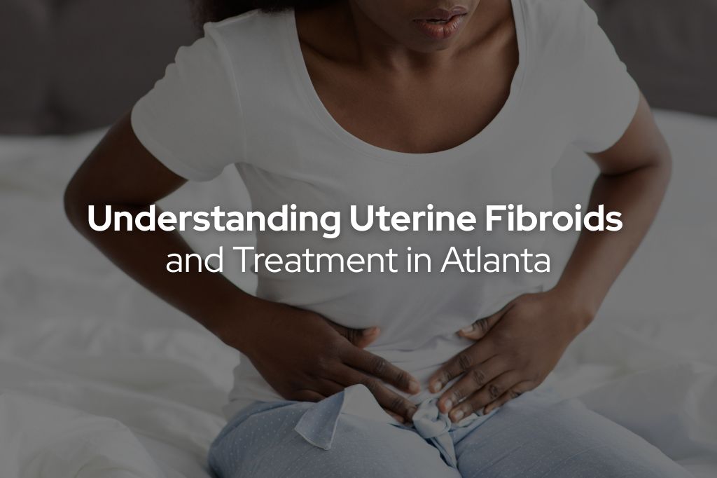 Understanding Uterine Fibroids and Treatment in Atlanta