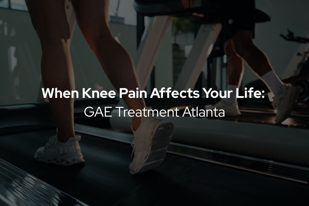 GAE Treatment Atlanta | Relief for Knee Pain