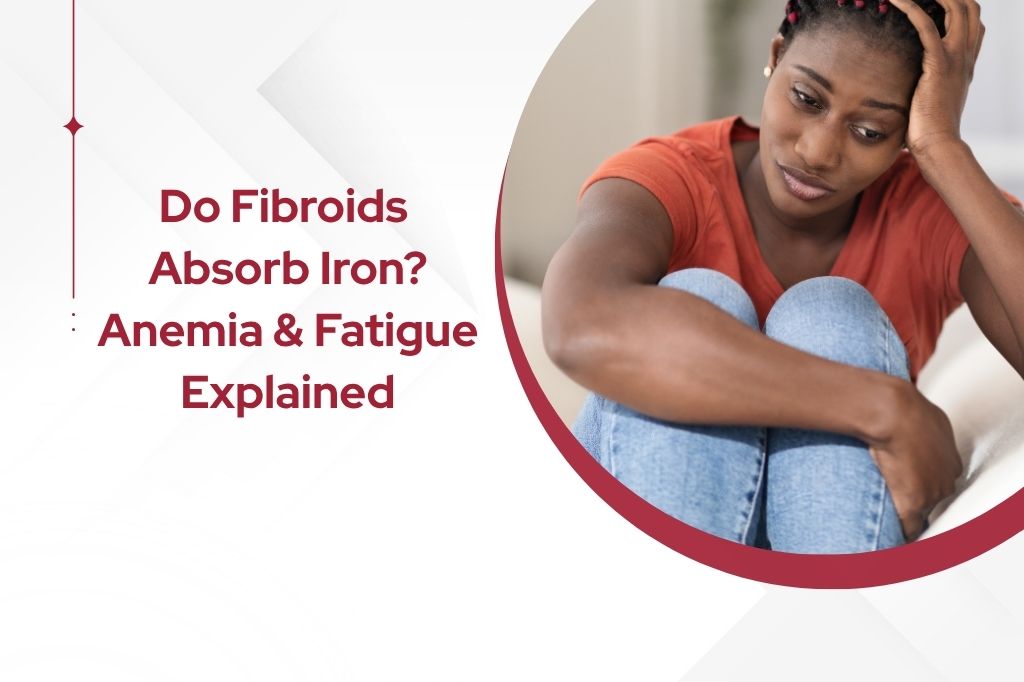 Fibroids, Anemia & Fatigue | Atlanta UFE Treatment